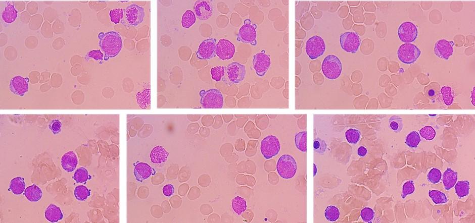 Clinical Case Fig 1